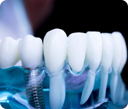 Çene Eklemi TME Tedavisi